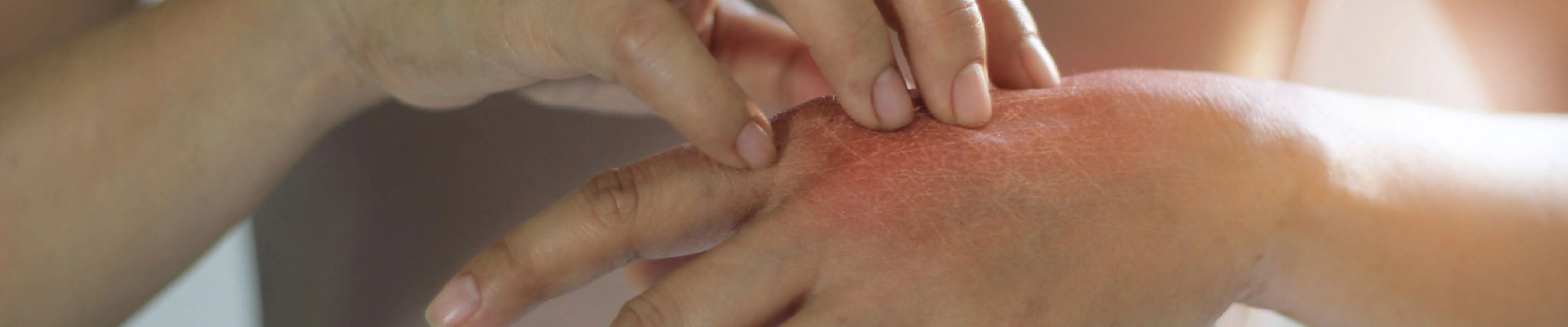 carpet cleaning in queens, carpet cleaning queens, carpet cleaners in queens, carpet cleaners in queens, commercial carpet cleaning, commercial carpet cleaning in queens, queens rug cleaners, rug cleaning services in queens, same day carpet cleaning, same day rug cleaning in queens